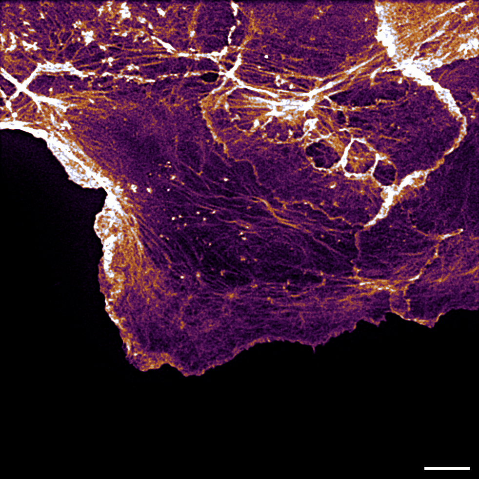 Embryo cells of the spiny plunderfish shown in layers. Embryo cells of the spiny plunderfish shown in layers.